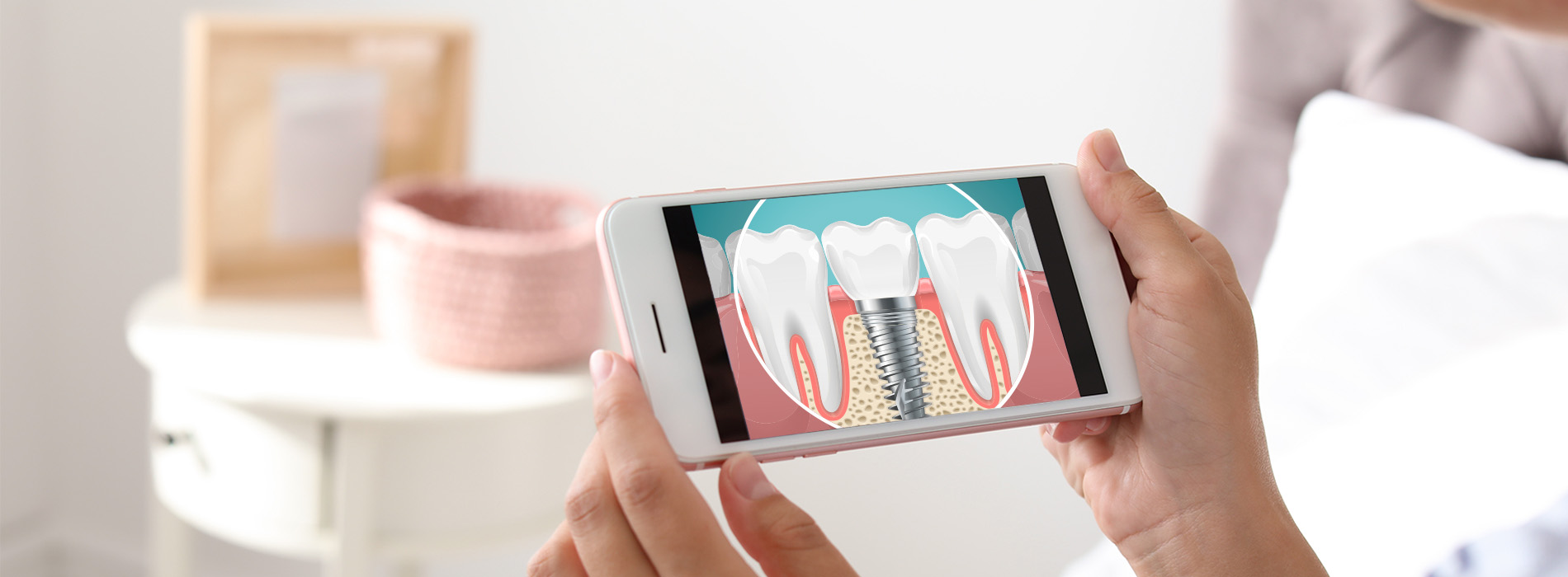 A smartphone displaying a graphic of teeth with dental implants, held by a person s hands.