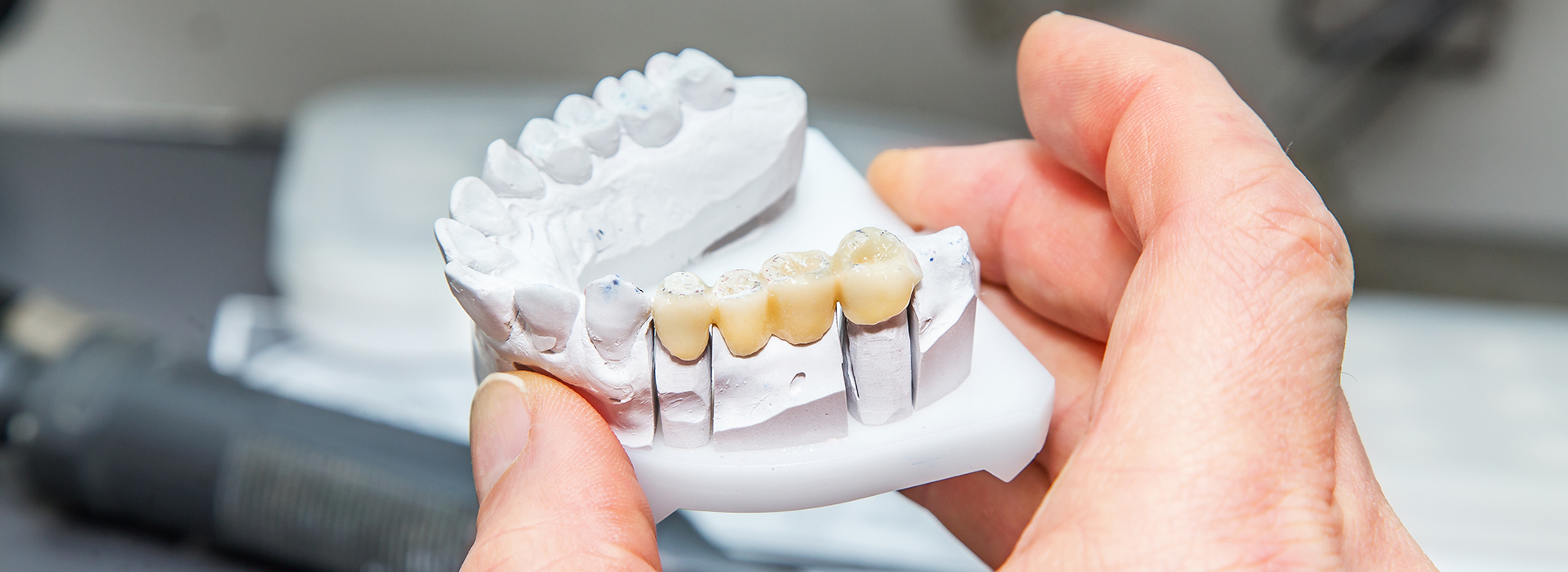 A person s hand holding a 3D printed dental model.