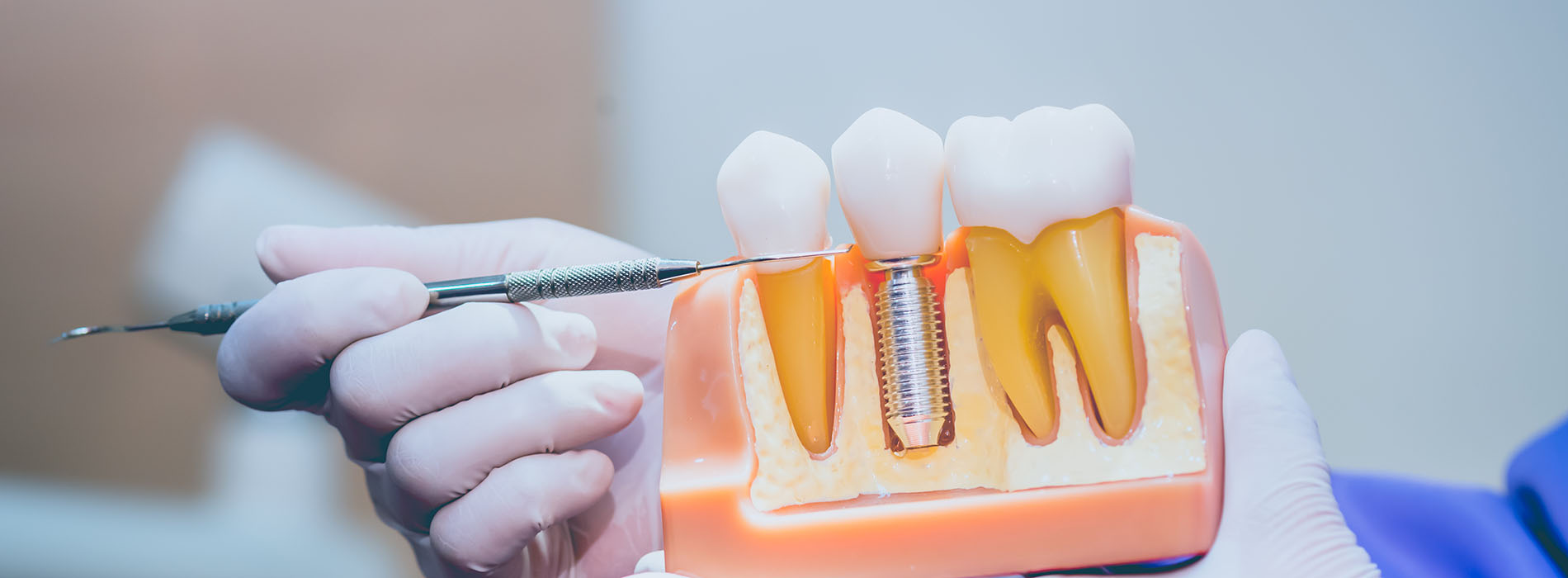 The image shows a person s hand holding a dental tool near an open mouth model with teeth and gums, which is placed in a clear plastic container.