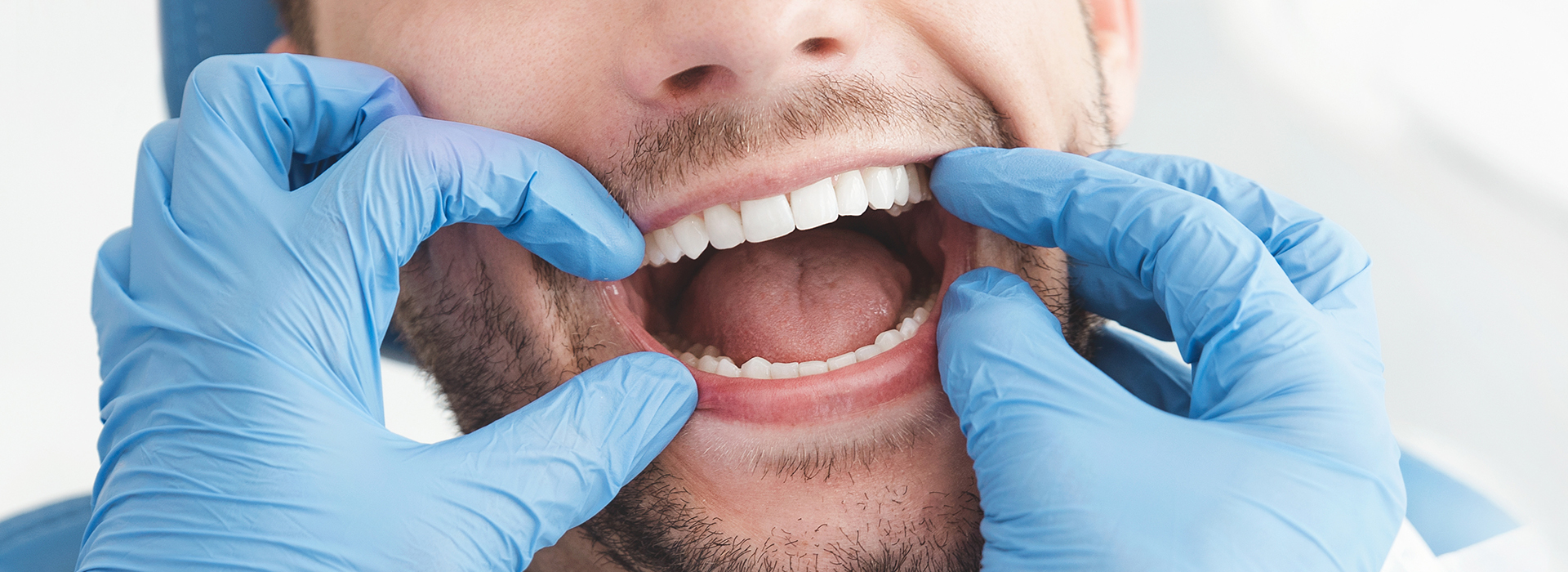 A man in a dental mask is holding his mouth open with one hand, showing his teeth, while another person s hands are seen manipulating the man s mouth from behind.